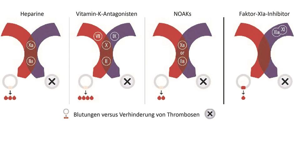 Thrombosen Verhindern, Ohne Das Blutungsrisiko Zu Steigern