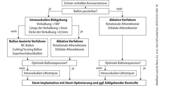 Treat the rock – Kalk als Challenge Abb. 1-- Behandlungsalgorithmus von schwer verkalkten Läsionen