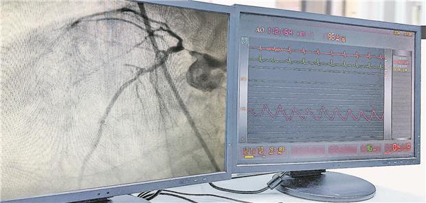 Angiografie machen – oder nicht: eine wichtige Entscheidung beim ACS. Tonpor Kasa/Getty Images/iStock