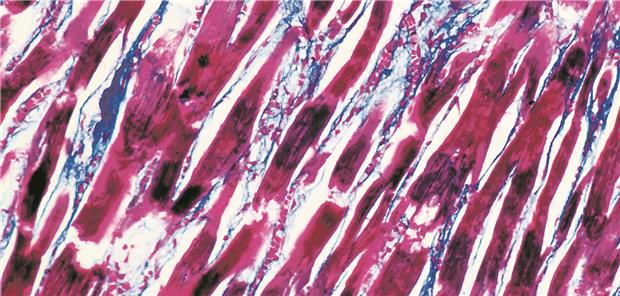 Nachweis einer myokardialen Inflammation Astrid & Hans-Frieder Michler/Science Photo Library