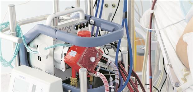 Rettet Reanimation mit ECMO Leben? Bei der extrakorporalen Reanimation übernimmt die ECMO Kreislauffunktion und Gasaustausch.