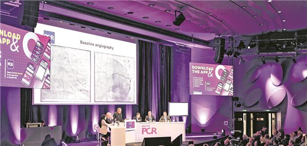 Metaanalyse entkräftet irritierenden Verdacht Beim EuroPCR-Kongress werden wichtige Studien der interventionellen Kardiologie vorgestellt.