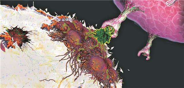 CAR-T-Zellen binden bestimmte, für Krebserkrankungen relevante Oberflächenmoleküle.