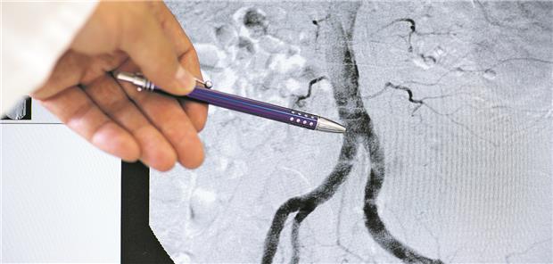 Neuer Aufbaukurs zur Gefäßmedizin Die Angiografie ermöglicht die Untersuchung der Blutgefäße ohne operativen Eingriff.