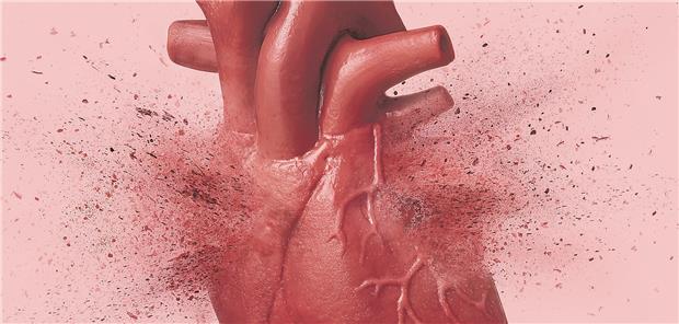 Subklinisches VHF antikoagulieren? Die Antikoagulation von subklinischem Vorhofflimmern ist eine Wanderung auf einem sehr schmalen Grat. Nymphalyda/stock.adobe.com