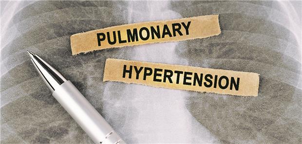Die Pulmonale Hypertonie ist keine eigenständige Erkrankung.