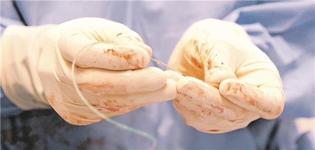 Bei ischämischer Kardiomyopathie revaskularisieren – Ja oder Nein? Eine Revaskularisation mittels PCI hat in REVIVED keinen Prognosevorteil gebracht.