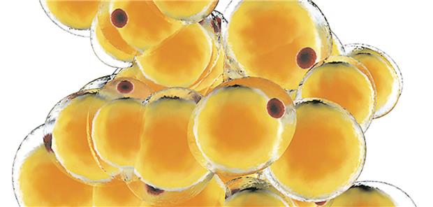 Adipositas bei HFpEF Gewicht bei HFpEF reduzieren.Spectral-Design/stock.adobe.com