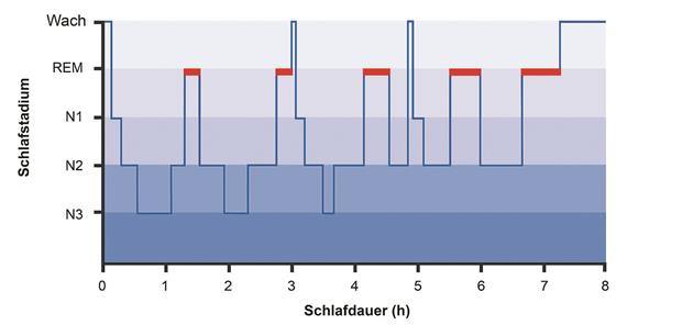 Menschliche Schlafarchitektur (Abb. 1)-- Hypnogramm eines typischen gesunden Erwachsenen.REM= rapid eye movement, Traumschlaf, rot; N1, N2 = Leichtschlaf, N3 = Tiefschlaf.[M] Cordelia Molloy/Science Photo Library