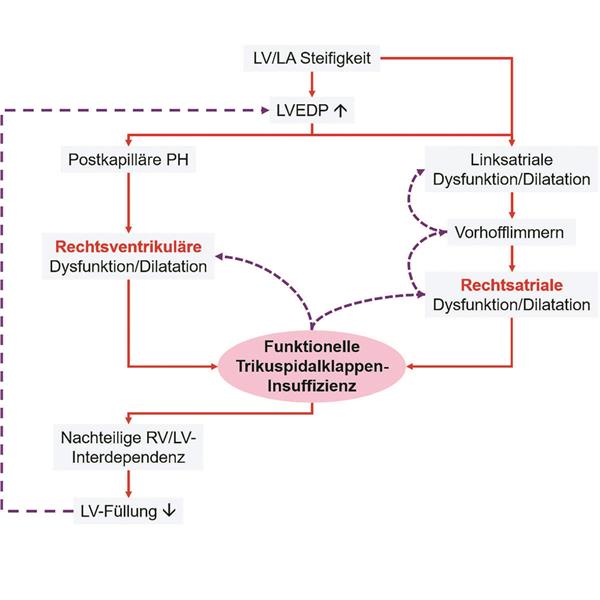Schlechtere Prognose: TI bei HFpEF Pathophysiologisches Konzept (Abb. 1)-- Genese der funktionellen Trikuspidalklappeninsuffizienz bei HFpEF. Besler LA: linker Vorhof, LV: linker Ventrikel,LVEDP: linksventrikulärer enddiastolischer Druck,PH: pulmonale Hypertonie, RV: rechter Ventrikel.