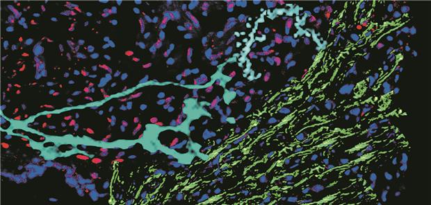 Nerven- und Immunsystem reparieren Herzen Schnitt durch ein verletztes Zebrafischherz-- Immunofluoreszenz zeigt die zellulären und extrazellulären Komponenten, die für die Erholung des Herzens entscheidend sind. Onur Apaydin