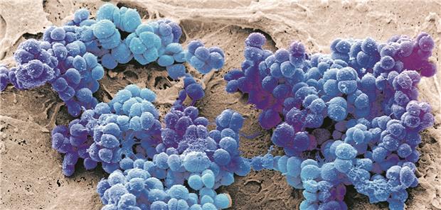 Staphylokokkus aureus ist einer der am häufigsten bei TAVI-IE isolierten Erreger. Steve Gschmeissner/Science Photo Library