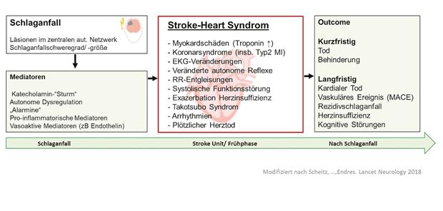 Das Stroke-Heart-Syndrom Überblick zur Entstehung, Manifestation und Auswirkungen von kardialen Komplikationen im Sinne eines Stroke-Heart-Syndroms.